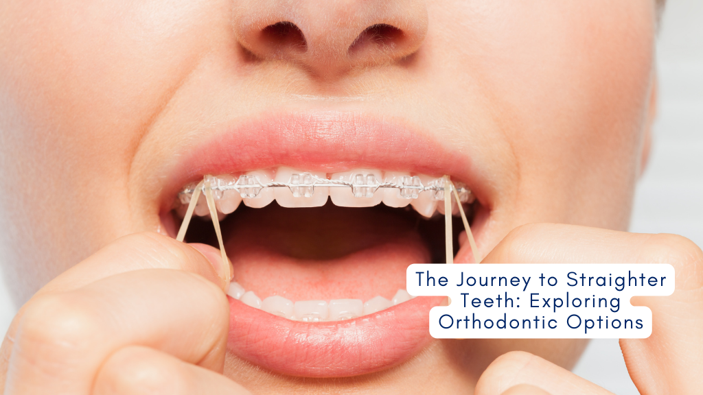 Straighter Teeth: Exploring Orthodontic Options