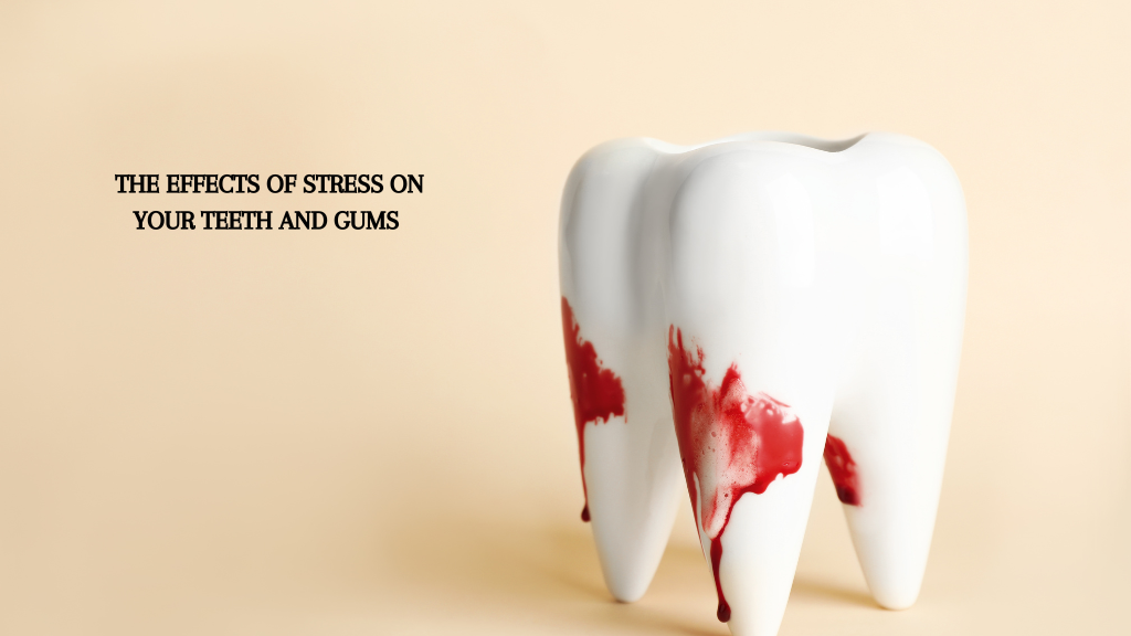 Effects of Stress on Your Teeth and Gums