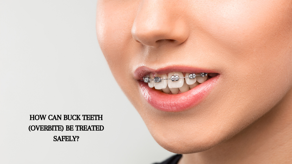 How can Buck Teeth (Overbite) be treated safely?