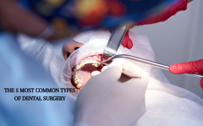 The 5 Most Common Types of Dental Surgery