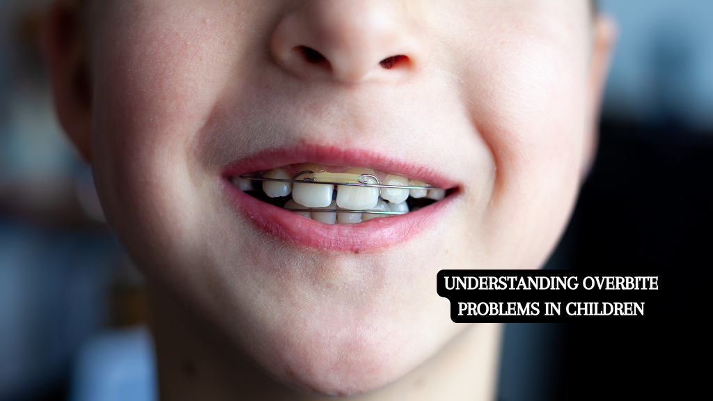 Understanding Overbite Problems in Children