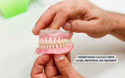 Understanding Calculus Teeth: Causes, Prevention, and Treatment