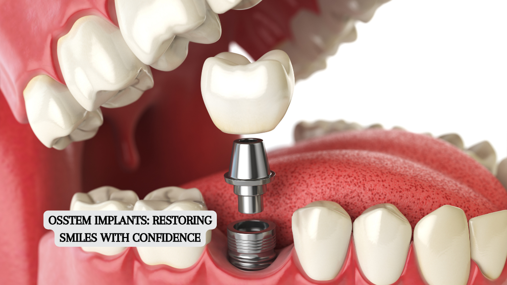 Osstem Implants: Restoring Smiles with Confidence