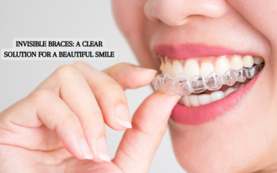 Invisible Braces: A Clear Solution for a Beautiful Smile