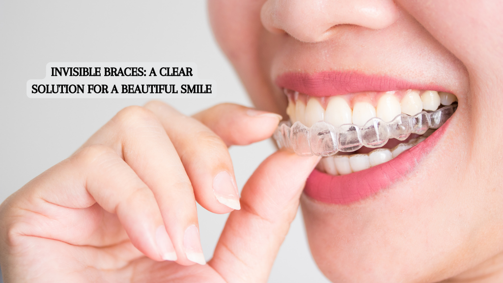 Invisible Braces: A Clear Solution for a Beautiful Smile