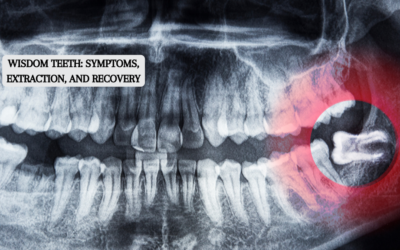 Wisdom Teeth: Symptoms, Extraction, and Recovery