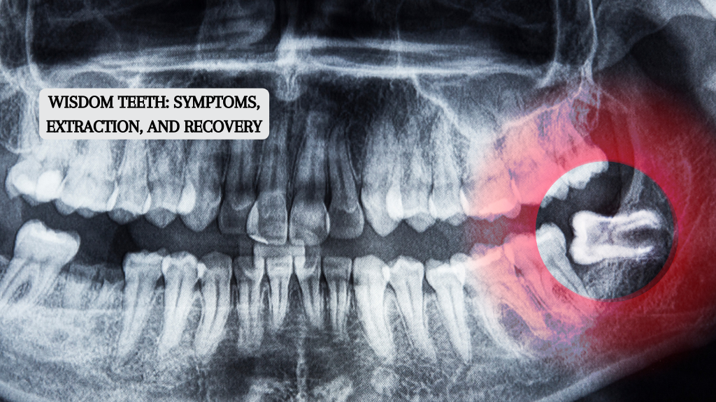 Wisdom Teeth: Symptoms, Extraction, and Recovery