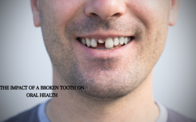 The Impact of a Broken Tooth on Oral Health