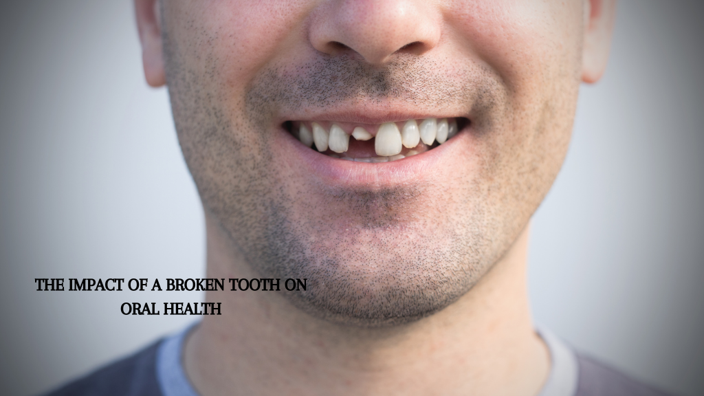 The Impact of a Broken Tooth on Oral Health