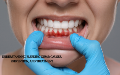 Understanding Bleeding Gums: Causes, Prevention, and Treatment