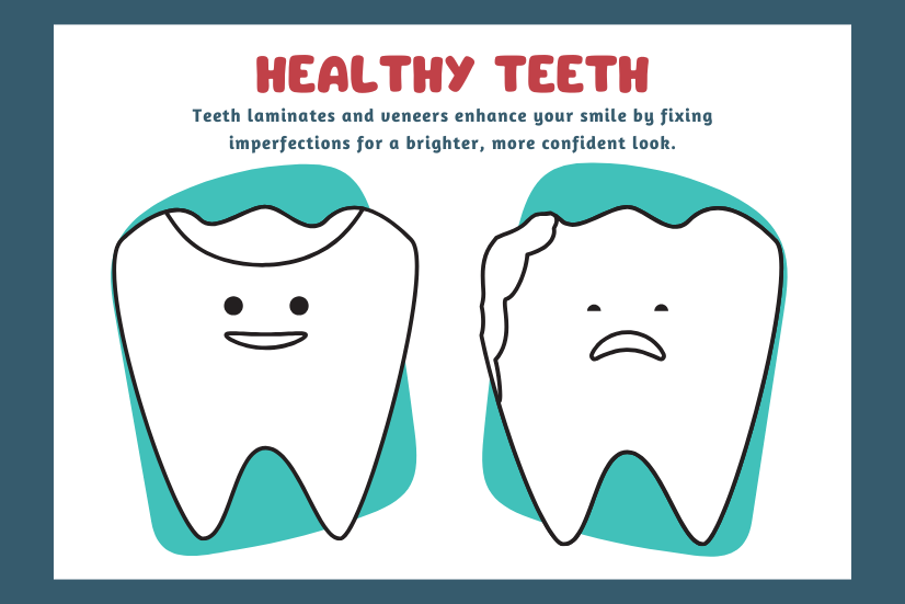 Teeth Laminates and Veneers: Your Path to a Brighter, Confident Smile